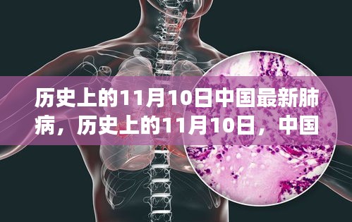 历史上的11月10日，中国肺病的新篇章——变化、学习与自信的力量展现时代变迁的力量