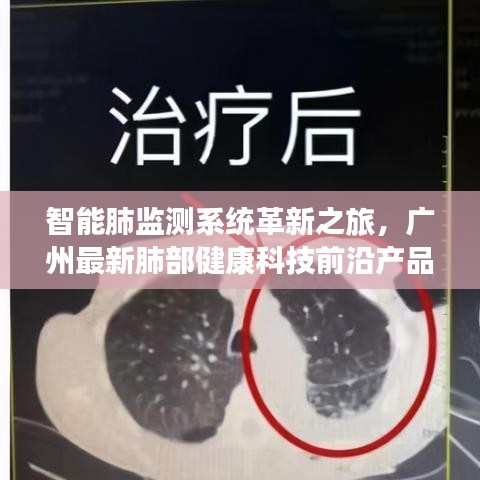 智能肺监测系统革新之旅，广州最新肺部健康科技前沿产品发布