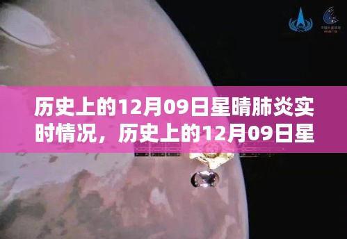 历史上的12月09日星晴肺炎实时情况深度解析与全面评测报告