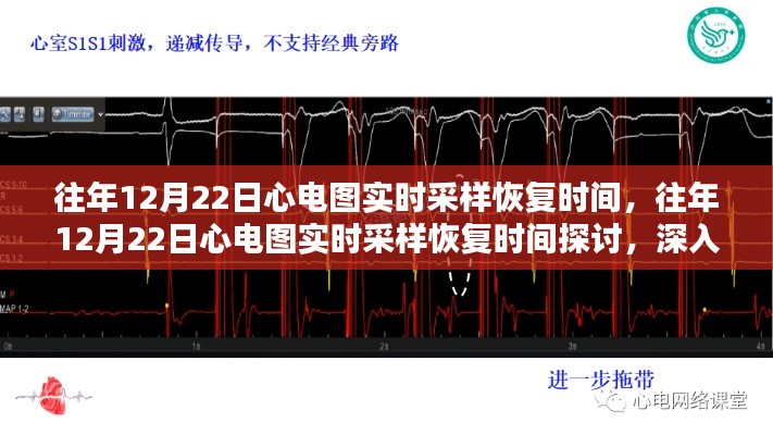 深入解析与观点阐述，往年12月22日心电图实时采样恢复时间探讨与观察